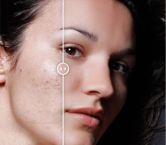 Portraiture 3 Plug In maakt het retoucheren van de huid eenvoudig
